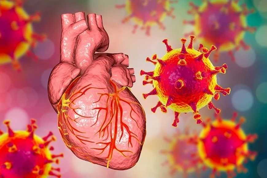COVID-19 vaccination associated with fewer heart attacks